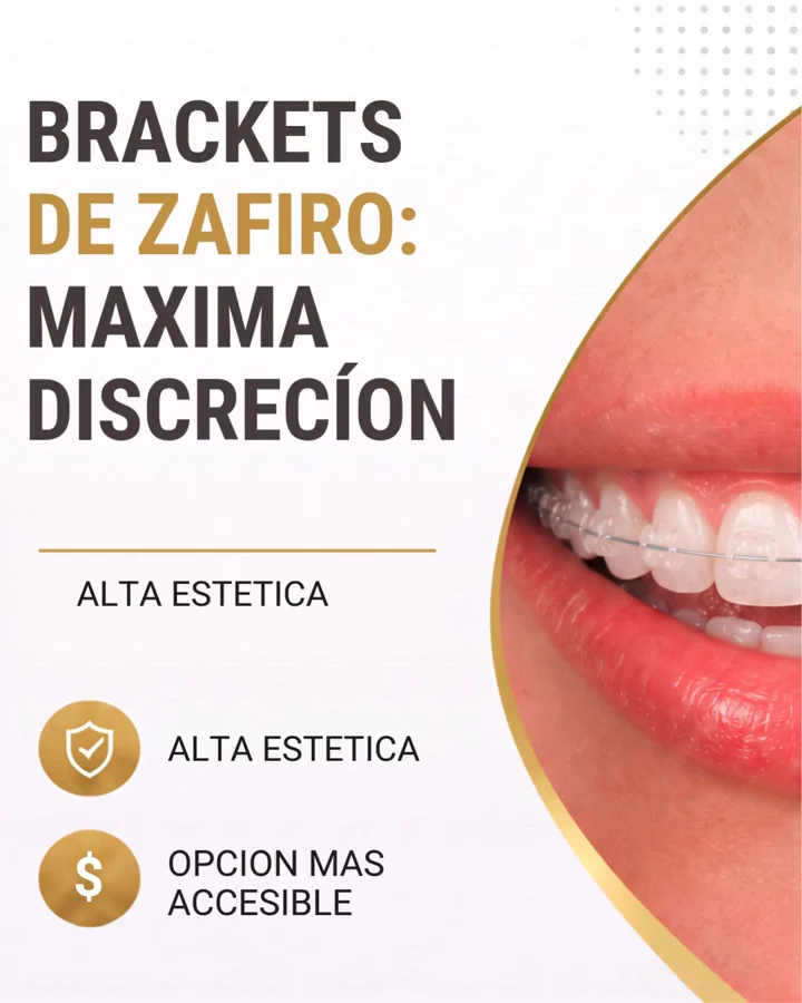 Carrusel que compara brackets metálicos y de zafiro. Slide 2 de 5