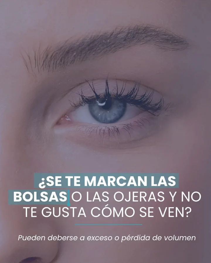 Carrusel sobre el tratamiento de ojeras y bolsas. Slide 1 de 4