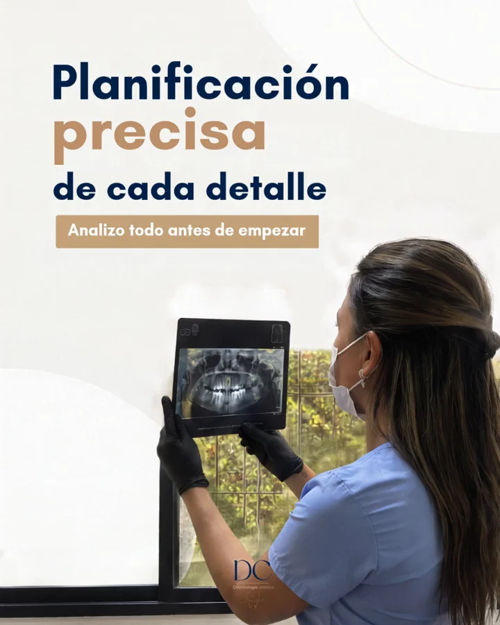 Carrusel sobre la planificación de un tratamiento de odontología estética. Slide 2 de 7