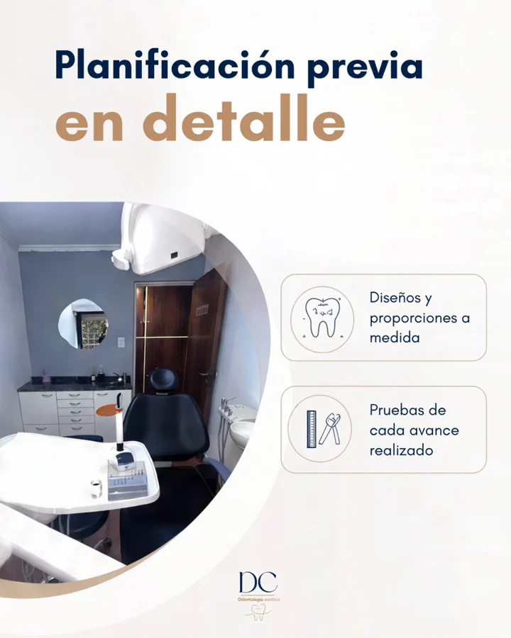 Carrusel sobre la planificación de un tratamiento de odontología estética. Slide 5 de 7